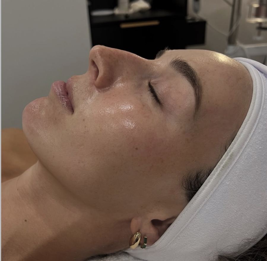 Glowing skin after a Hydrafacial at Ra'pôr on East 17th Street, Costa Mesa
